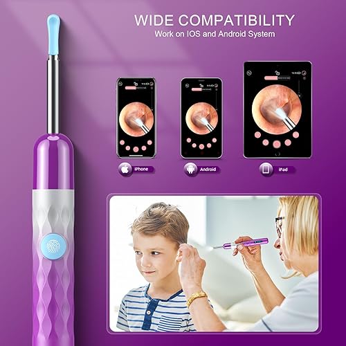 Miniatura 4 de ESHOWEE Eliminación de cera de oído, (1440P) cámara de oído de alta definición con 6 luces LED, limpiador de oídos con cámara WiFi incorporada, kit
