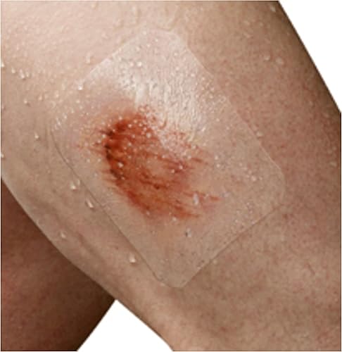 Vista 24 de Nexcare Tegaderm, apósito transparente, LEPAE995, 1, 1