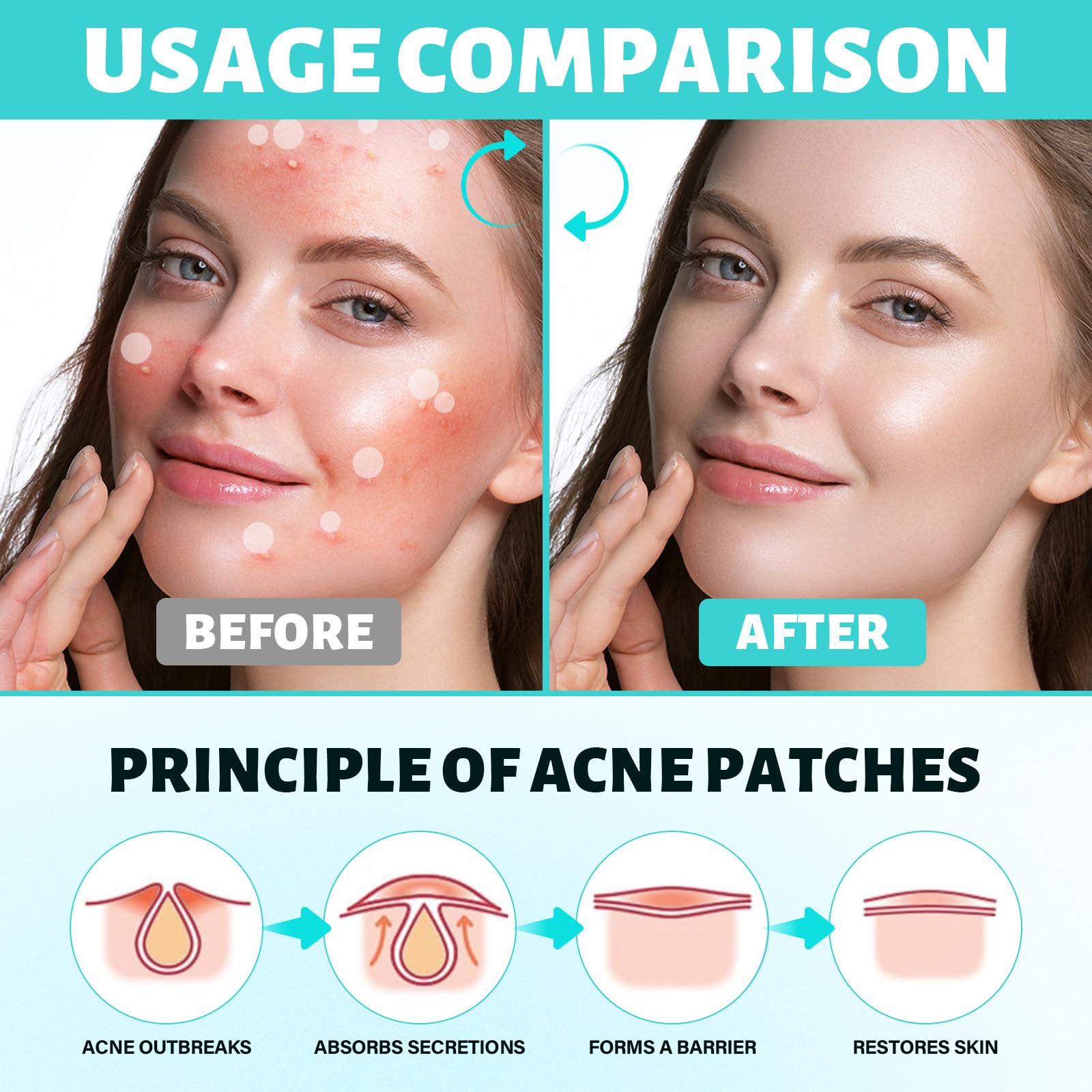 385 Pezzi Cerotti brufoli, Invisibili Cerotti Idrocolloidali, Con olio di Tea Tree e Centella Asiatica, Patch Brufoli Assorbenti Impermeabile e Traspirante, 2 In 1 Giorno e Notte Acne Patch