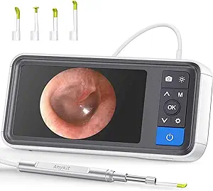 The Ultimate Buying Guide for Otoscope: Types, Features, Prices, and Tips
