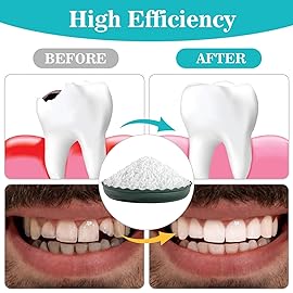 Sukh 10.9oz Moldable False Teeth Beads - Tooth Repair Kit,Repair Thermoplastic Beads,Plastic Pellets for DIY Tooth Filling,Halloween Vampire Teeth Fangs Ideal for Chipped, Cracked