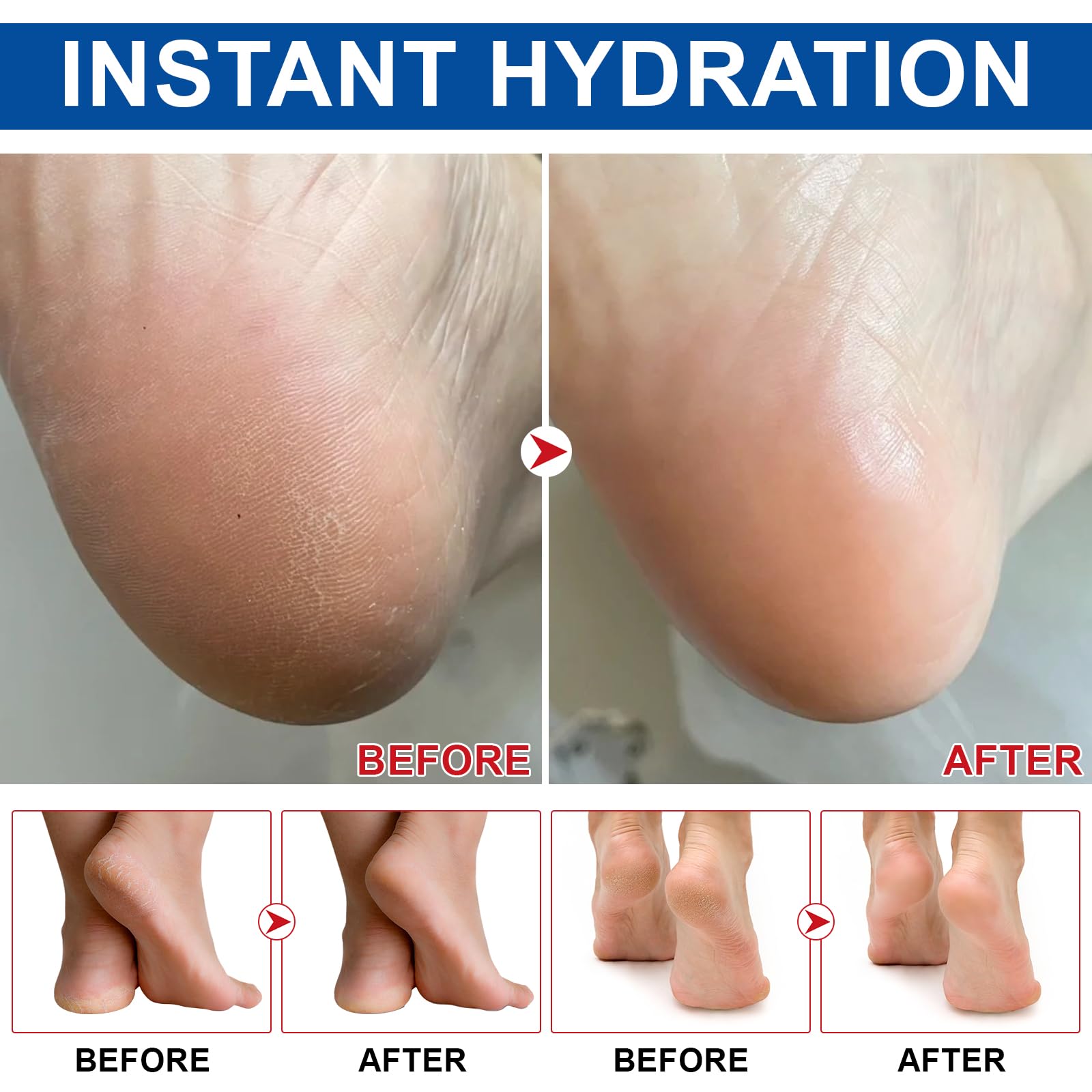 Crema all'urea al 60% per Piedi, Mani, Gomiti e Ginocchia - Riparazione Intensiva per Pelle Decca, Ruvida e Screpolata, Esfolia, Idrata e Leviga