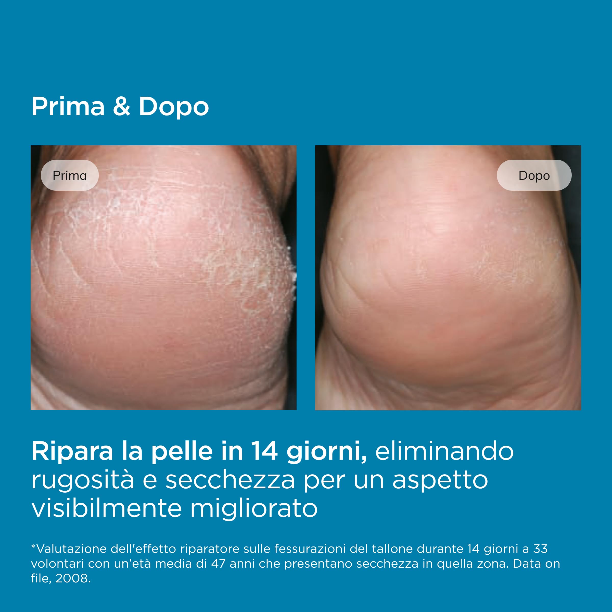 ISDIN Ureadin Podos (75 ml) | Gel Olio Idratante con 10% Urea | Ripara e Idrata i Piedi Secchi e Screpolati