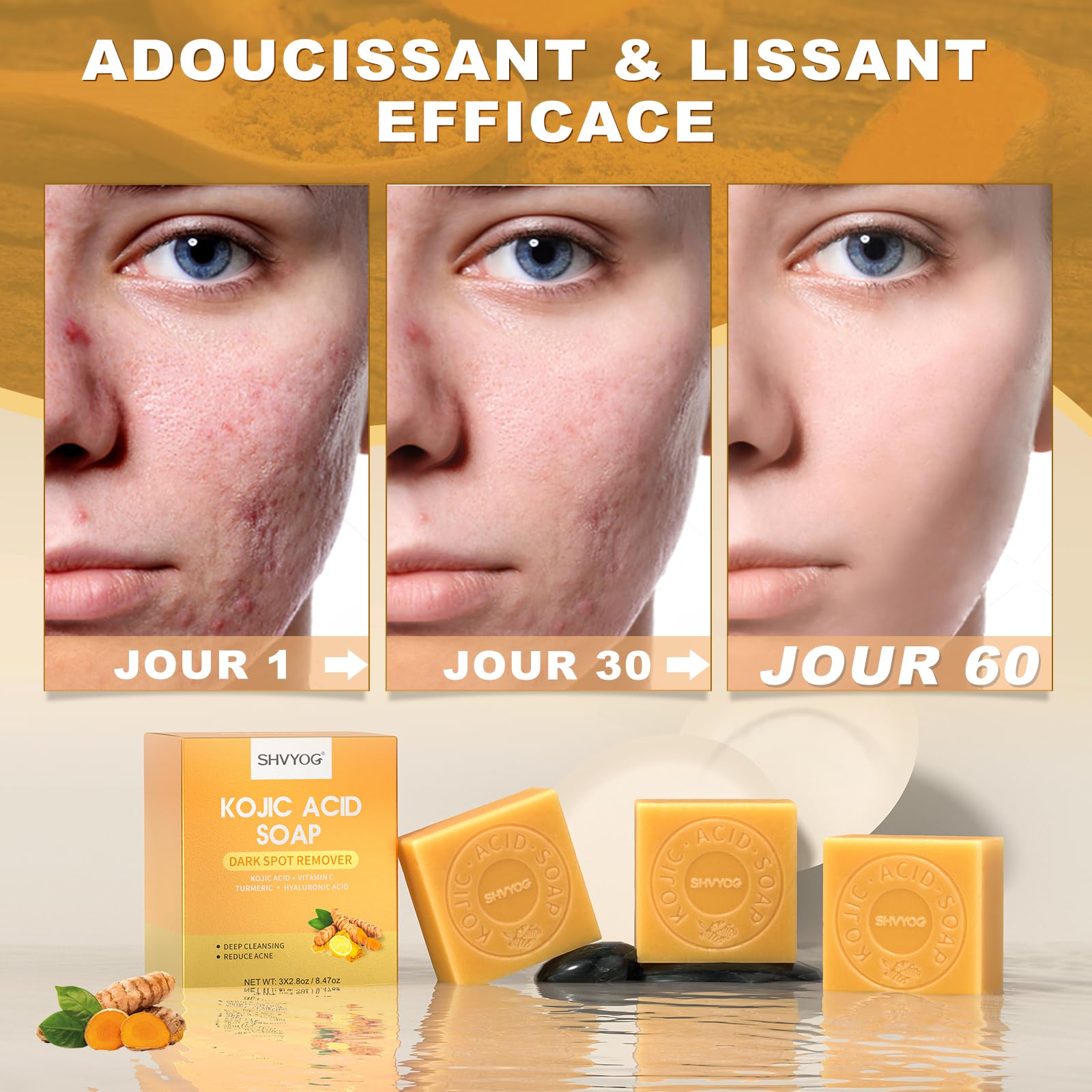 Savon à L'acide Kojique, Savon au Curcuma, VC Savonnette pour Eliminer Points Noirs, Acné et Taches Foncées, Doux pour l'Hydratation du Visage et Corps, Rétrécissement des Pores, 3x80g