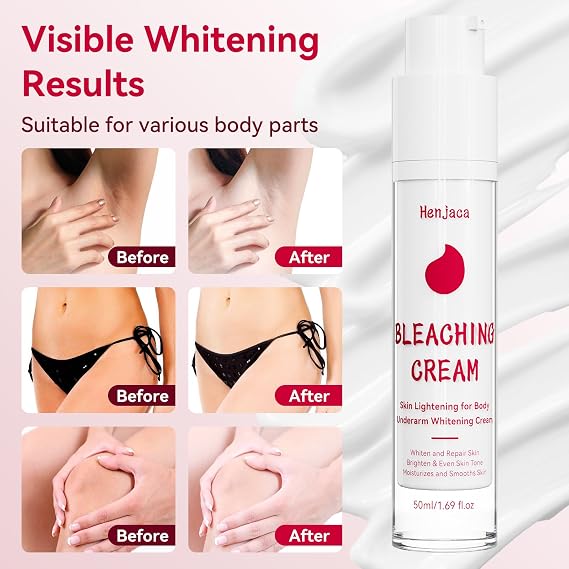 Skin Bleaching Cream, Lightening Cream with Vitamin C for Even Tone