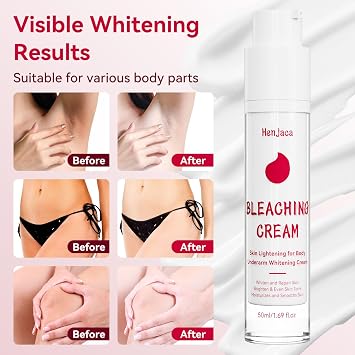 Skin Bleaching Cream, Lightening Cream with Vitamin C for Even Tone