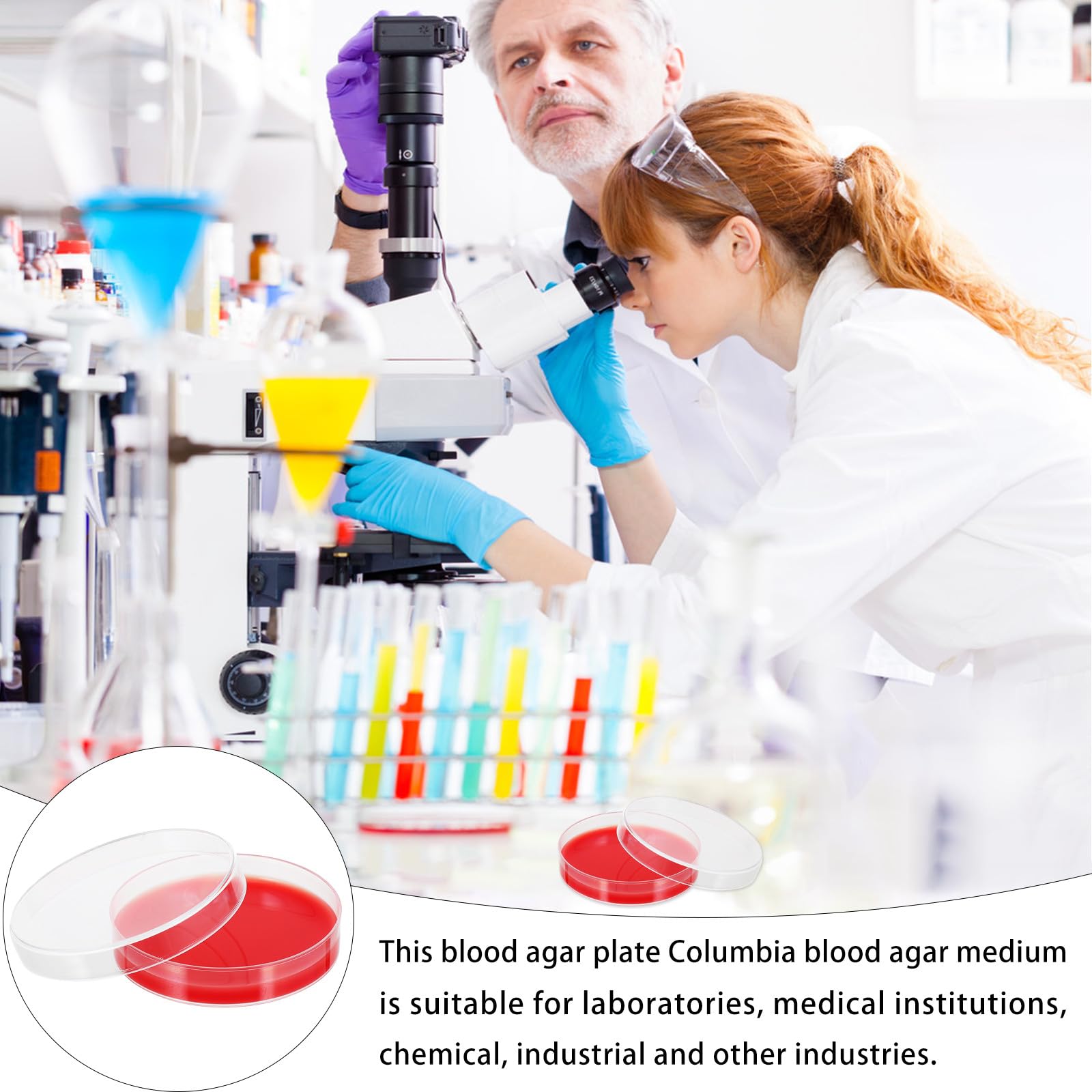 SECFOU 10 Placas de Agar con Hemoglobina para Laboratorio Cultivo Rojo, Material Pe, Precisión Moldeada para Uso Industrial Instituciones Médicas