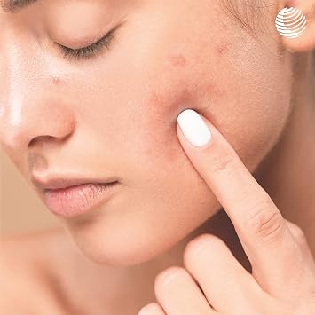 Dr. Rimpler Basic Clear Skin Stylist