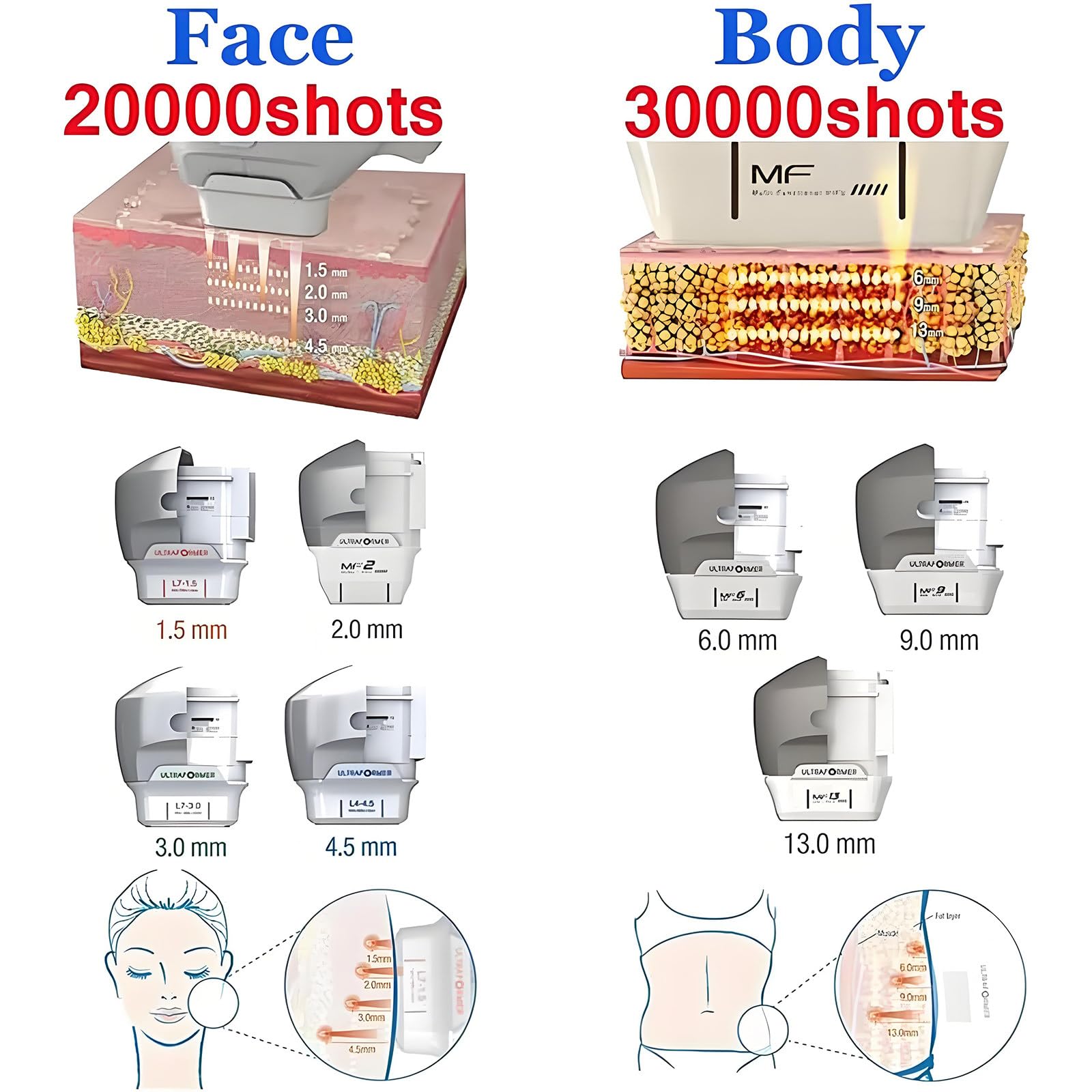 Dispositivo di Bellezza 7D HIFU per modellamento corporeo, diatermia, Dimagrimento, rimozione del Grasso corporeo, Lifting Viso Professionale, rassodamento della Pelle, Sollievo dal Dolore