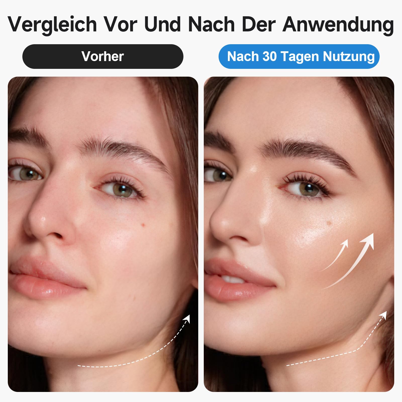 Schröpfgerät Elektrisch 3 in 1 Cellulite Massagegerät