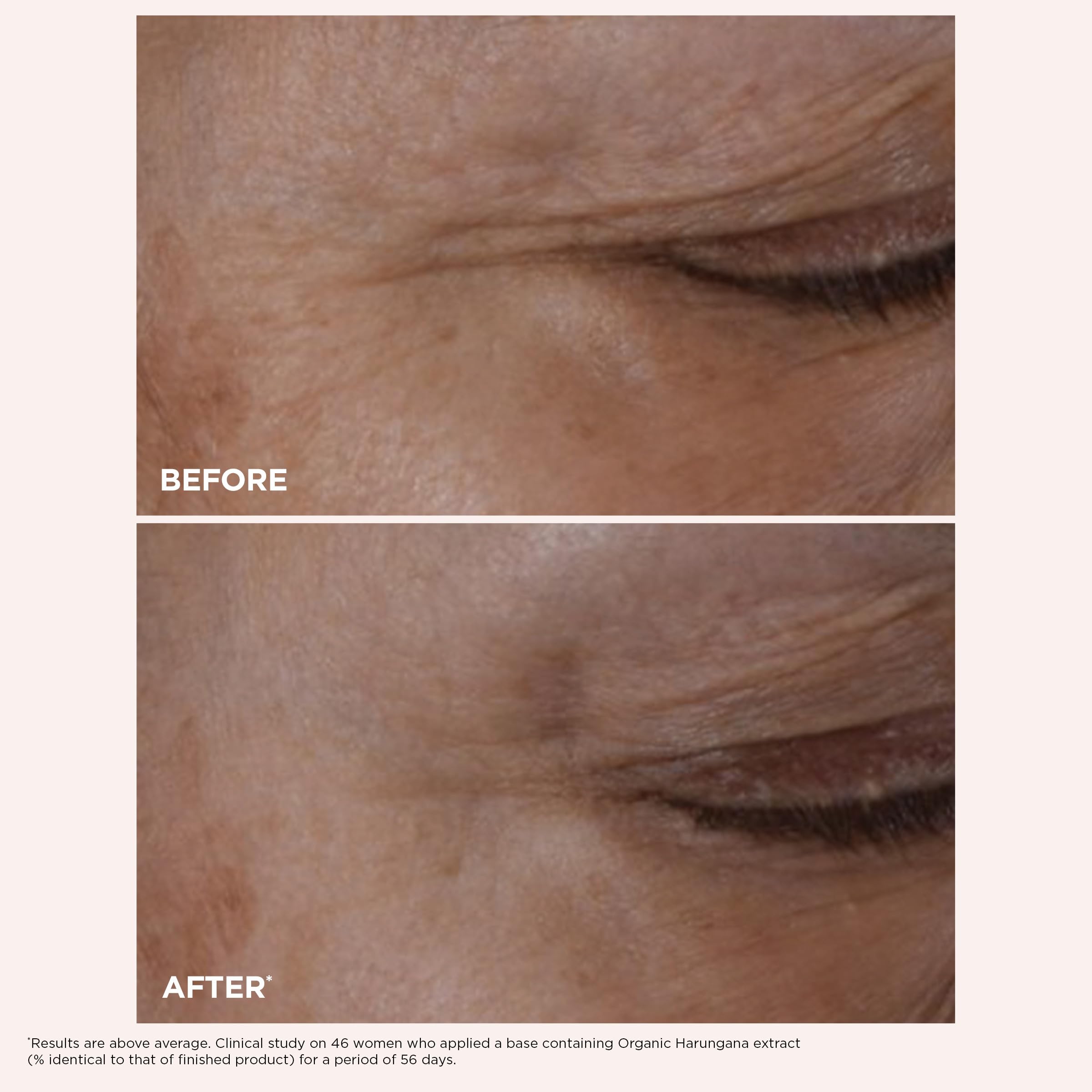 Clarins NEW Total Eye Lift | Anti Aging Eye Cream | Targets Wrinkles, Crow's Feet, Dark Circles and Puffiness For a Visible Eye Lift in 30 Seconds | REFILLABLE