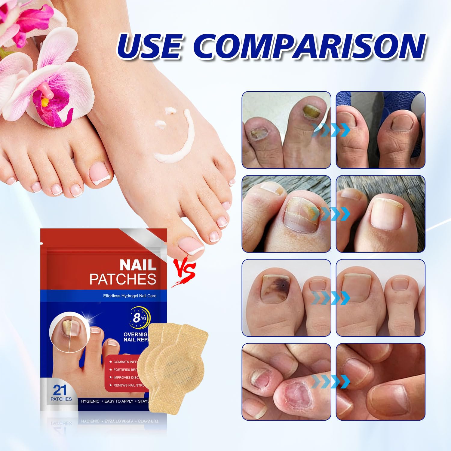 U5L-42 Stück Fungal Nail Patches Nagelpilz Pflaster Zehennagel Korrektur Patch Mehrzweck Pilz Nagel Patches für Beschädigte Nägel und das Erscheinungsbild Verfärbter Nägel (2 Packung)