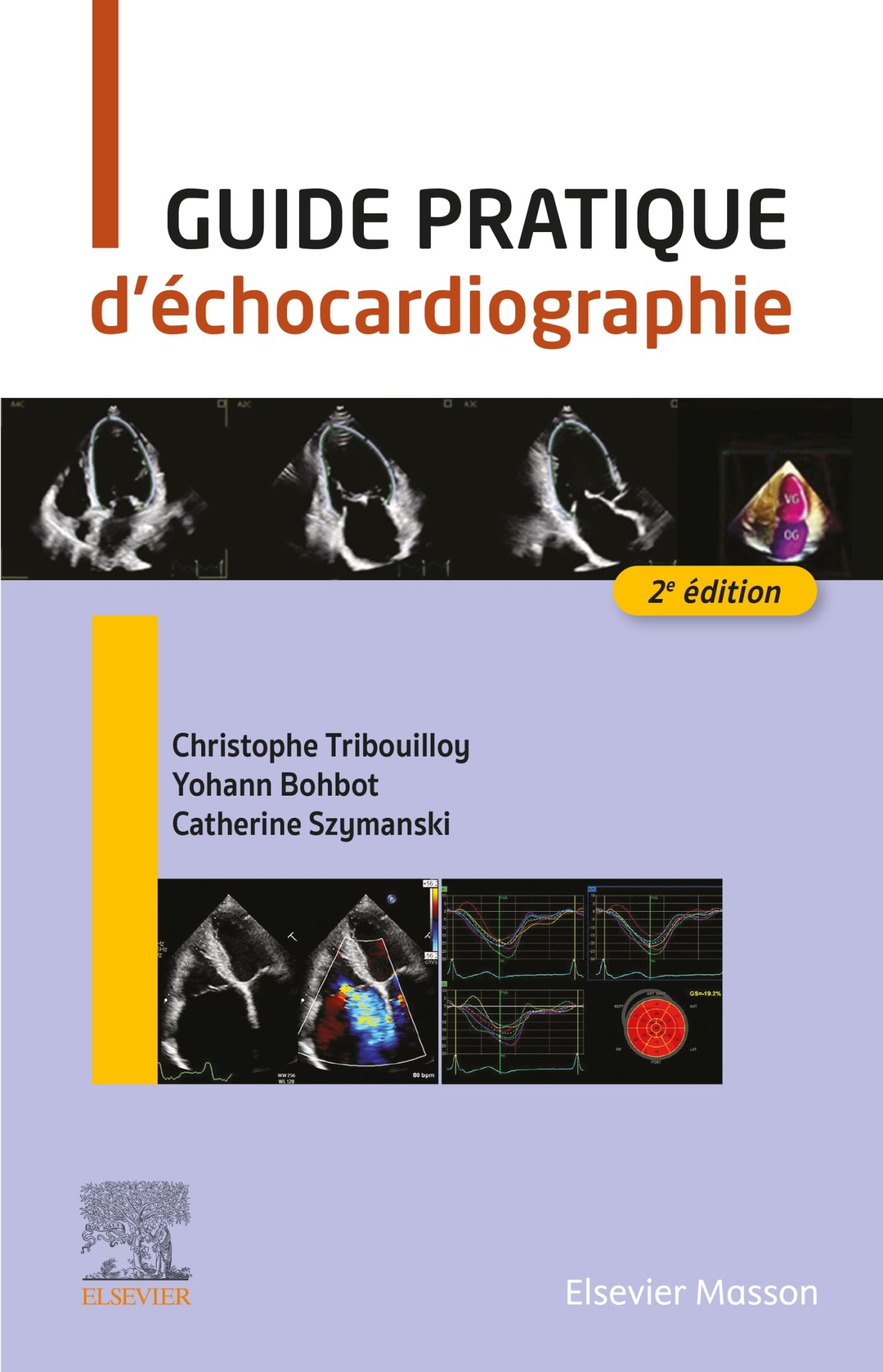 Guide pratique d'échocardiographie