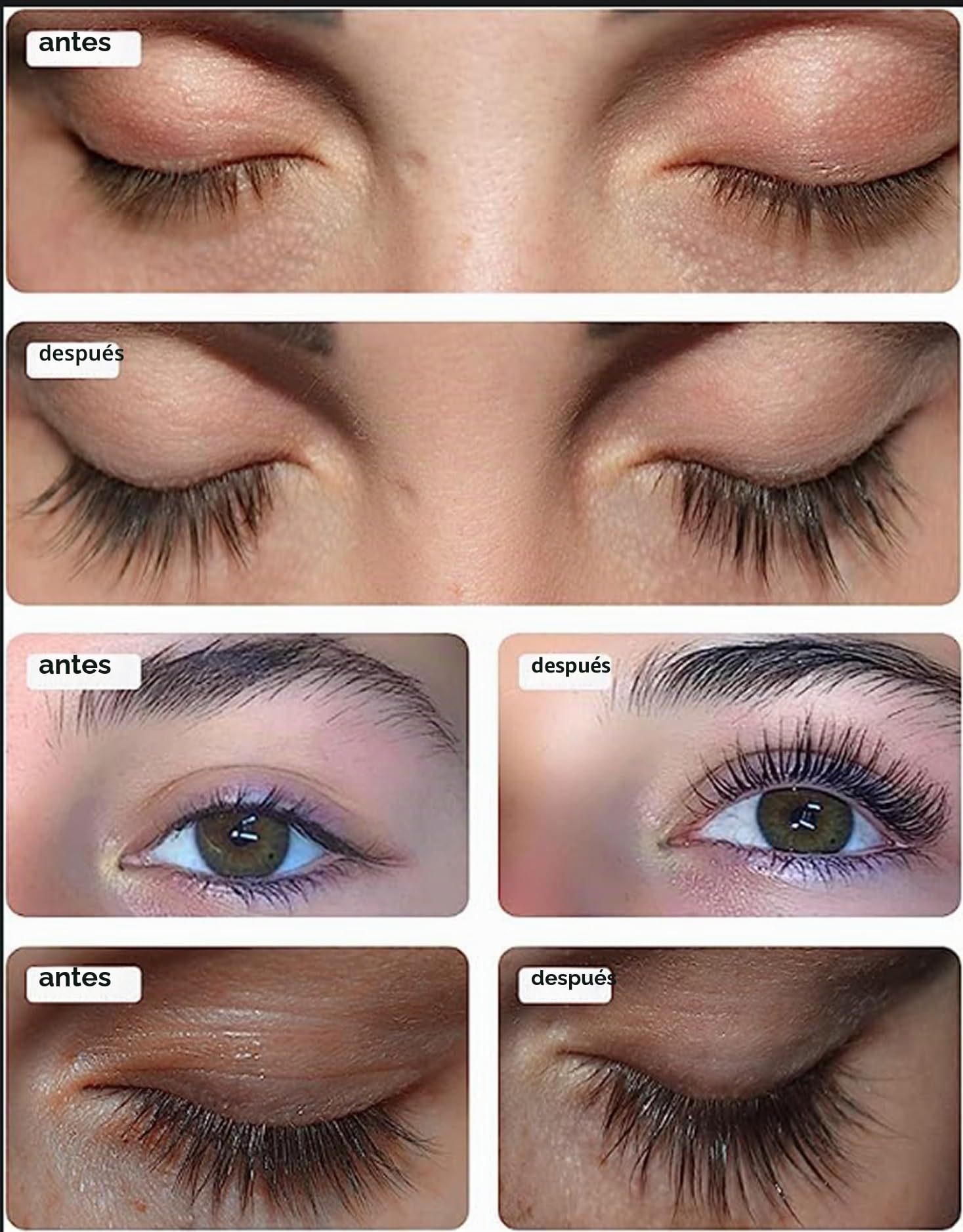 Toplash XL Lash and Brow Booster, Suero de Crecimiento con