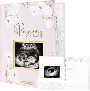 Pregnancy Journal, Pregnancy Announcements - 80 Pages Hard Cover Pregnancy Book For Mom To Be Gift - Pregnancy Gifts For New Moms - First Time Expecting Mom Gift - Baby Album And Memory Book (Blush)