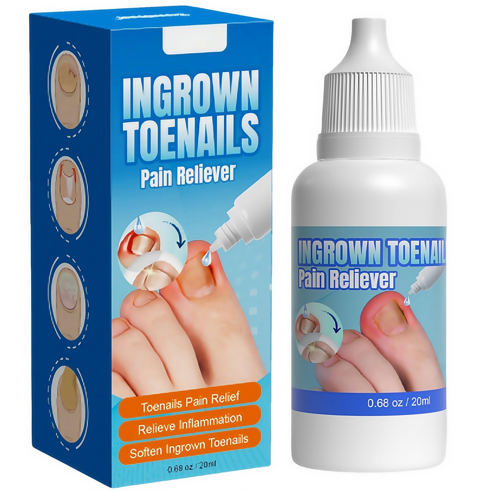 Ingrown Toenail Treatment, Ingrowing Toenail Treatment Extra-Strong, Ingrown Nail Treatments for Toenails 20ml