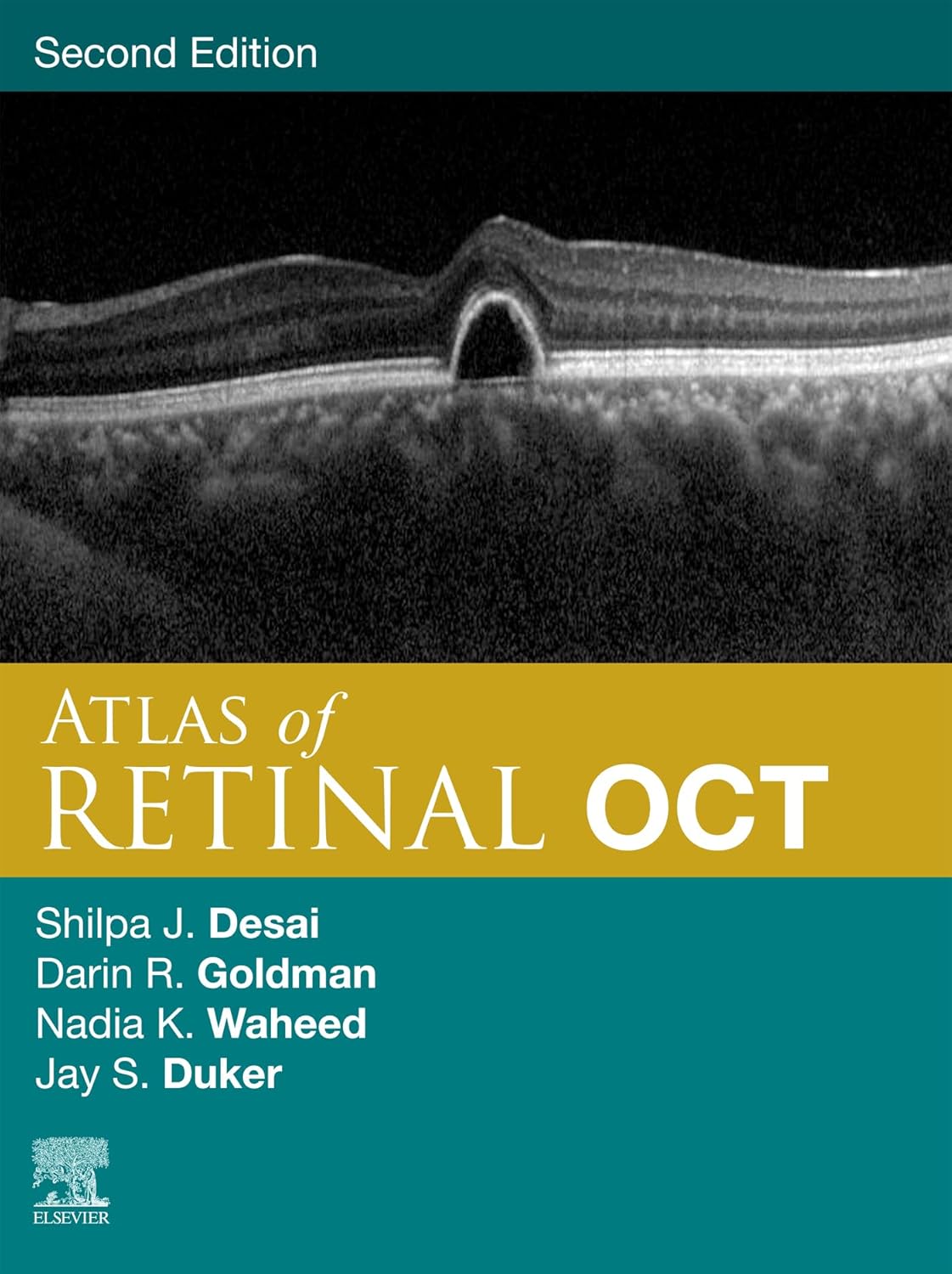 Atlas of Retinal OCT EBook Optical