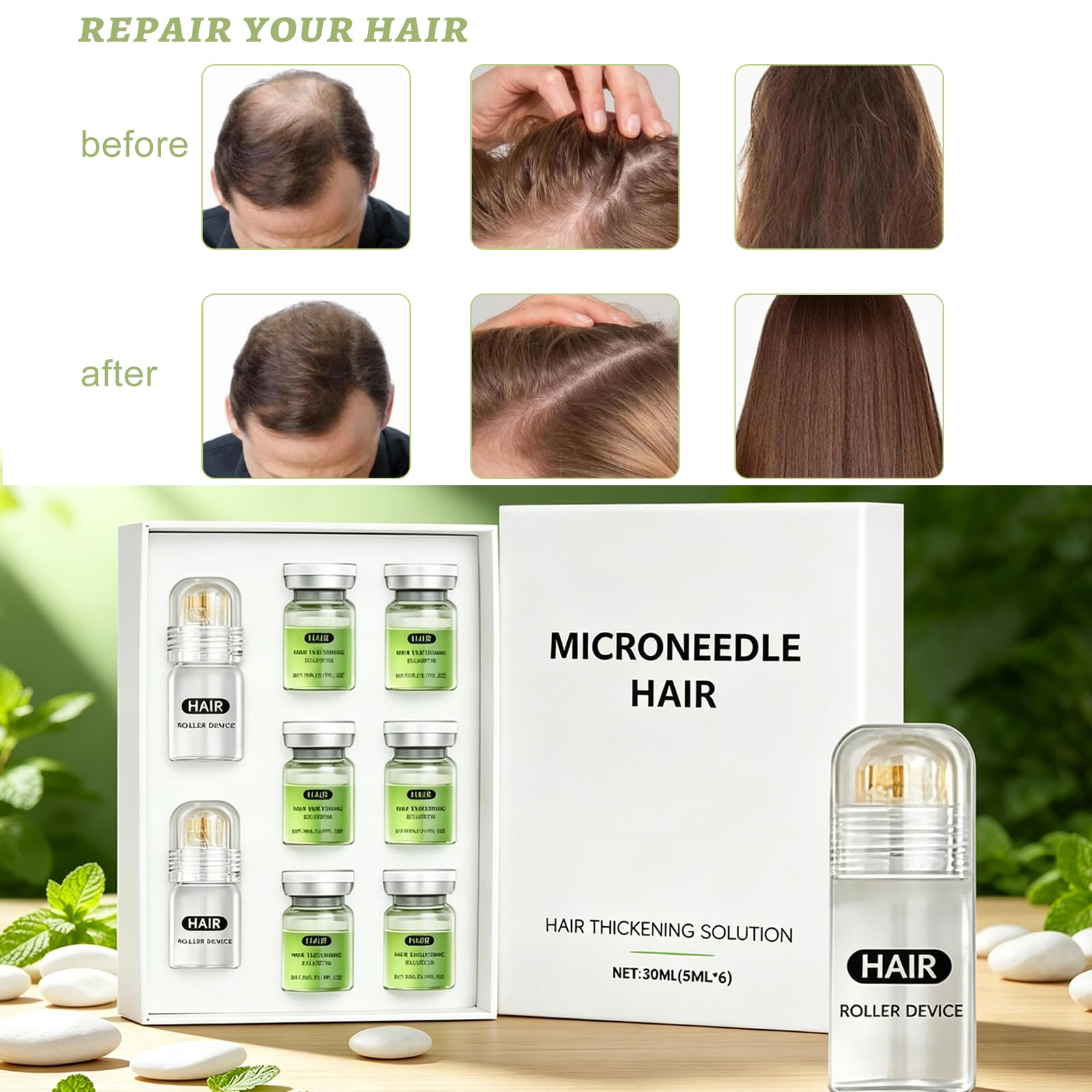 Microneedling, sistema di ricrescita dei capelli, Alpha Infuse Hair Growth Serum per rafforzare le radici dei capelli, favorisce la crescita dei capelli per la perdita di capelli, rinforza i capelli