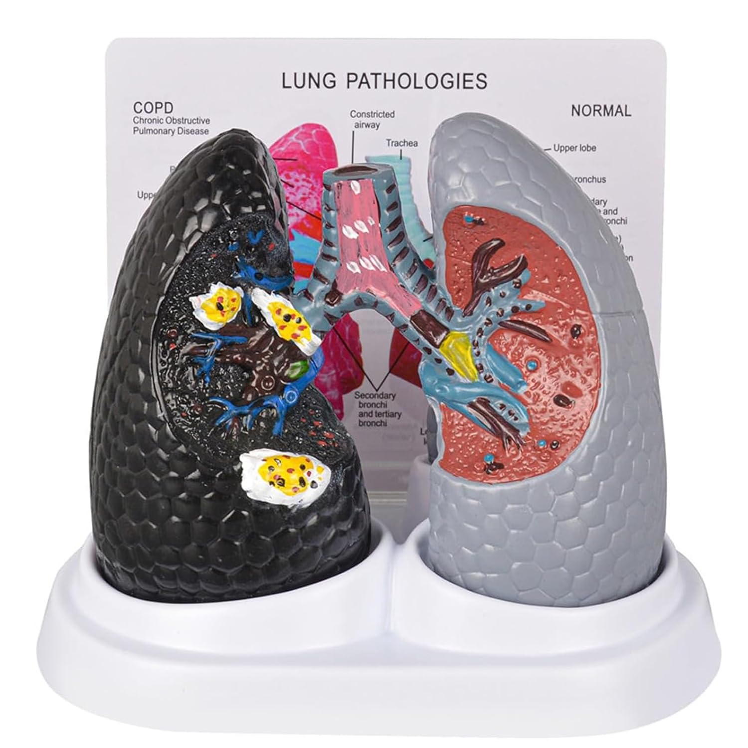 WHOOLEFUN Healthy Lung Vs. Smokers Lung Model Set, Lung Anatomy Model for Smoking Education, with English Back Card and Base, Human Respiratory System Organ, for Medical Teaching, Health Education