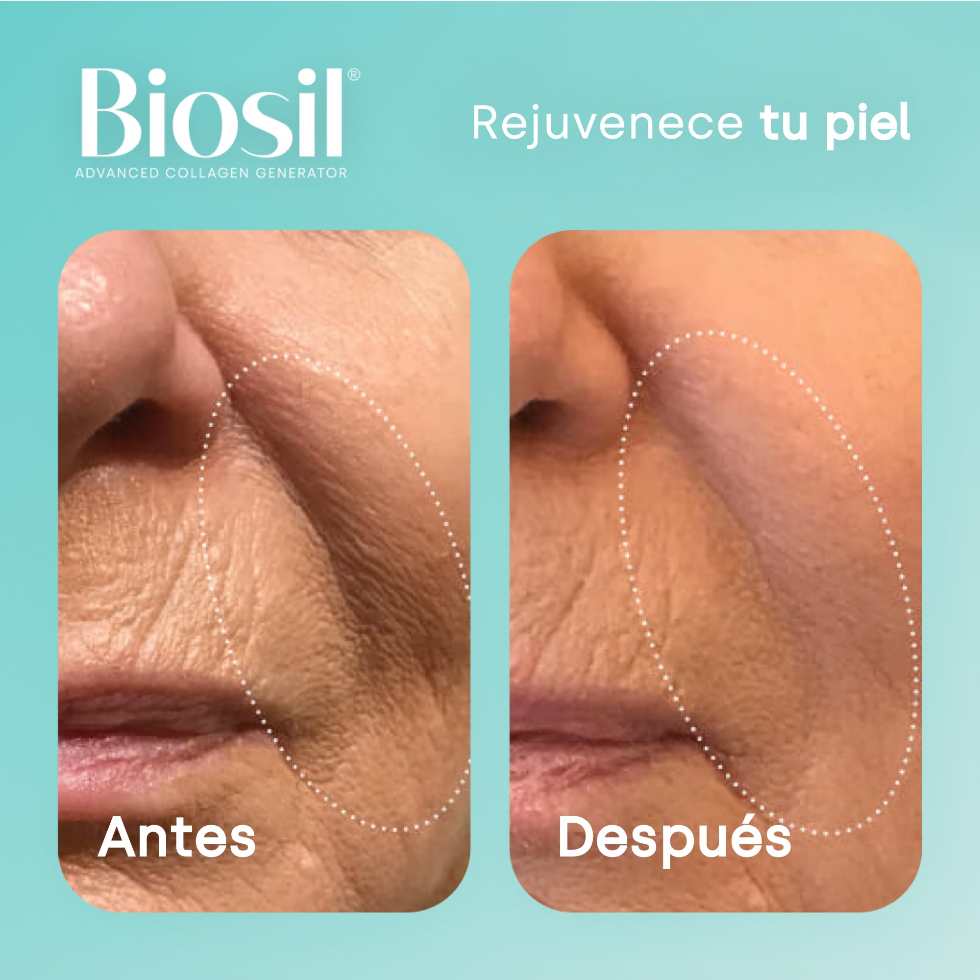 Biosil Collagen Generator - Gotas de 30 ml