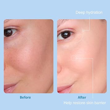 500ml Hyaluronic Acid Skincare Set 5 Bottle, 7 Set Facial Serum Pods Kit for CO2 Oxygen Facial Machine