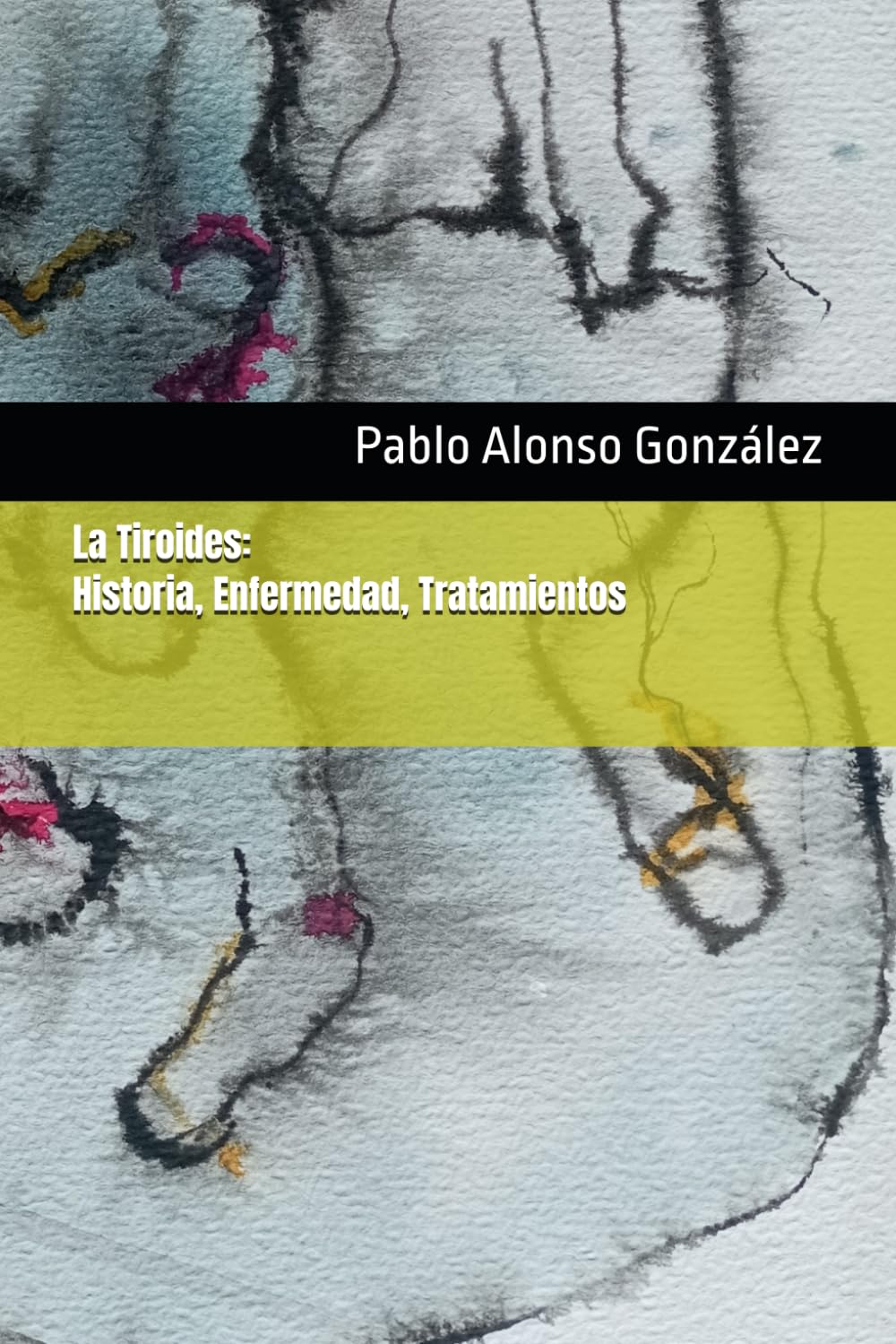 La Tiroides: Historia, enfermedad, tratamientos (Ray Peat y el enfoque bioenergético)