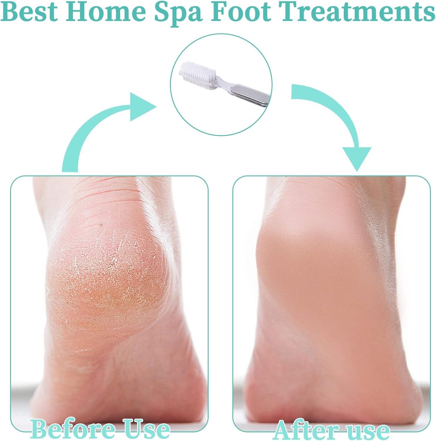 2 Pcs 4 in 1 Foot File Callus Remover, Multipurpose Pedicure Tools for Feet with Brush, Foot Rasp, Pumice Stone & Sand Paper, Remove Hard Skin Scrubber Brush for Women Men Feet Care