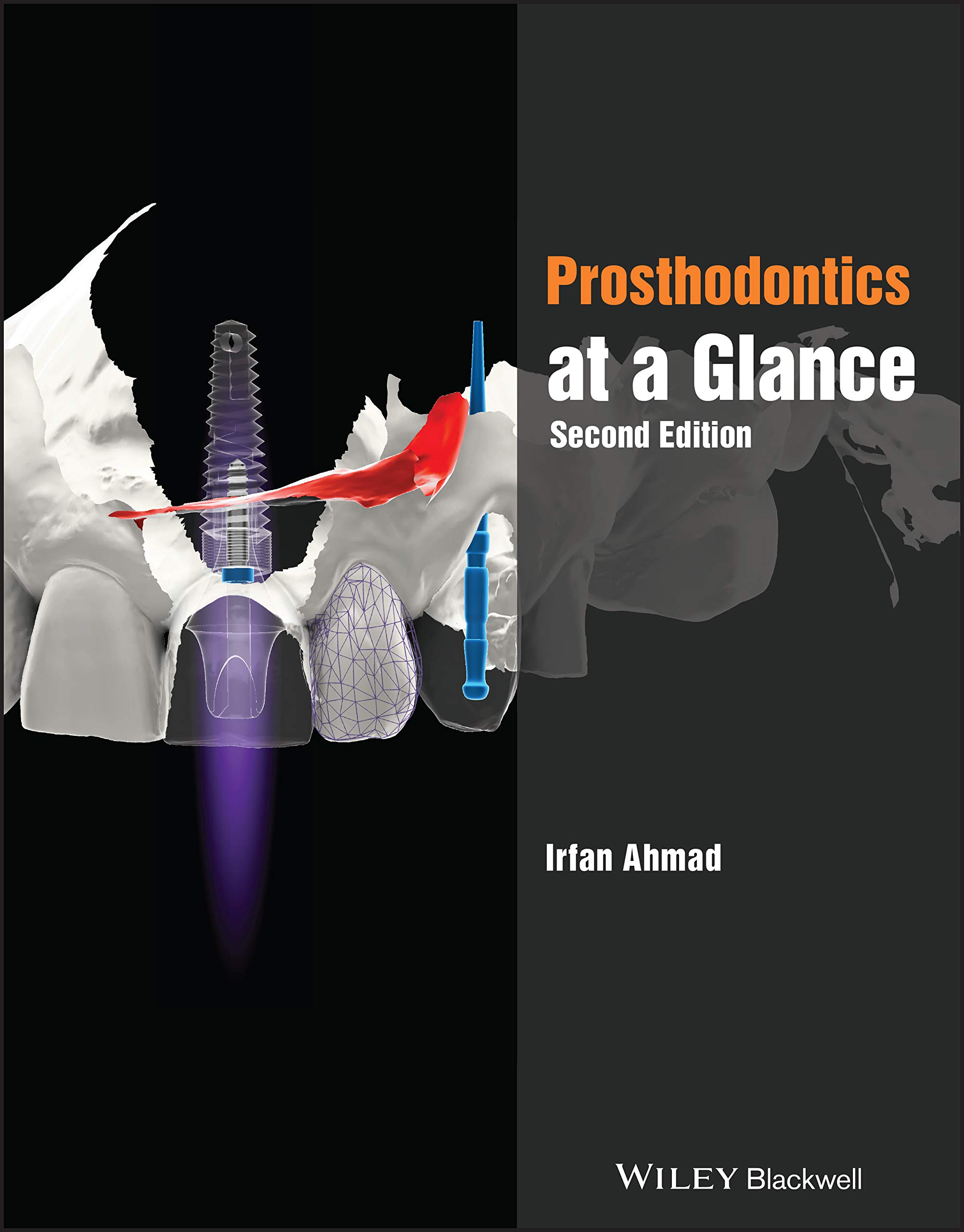 Wiley-Blackwell Prosthodontics at a Glance