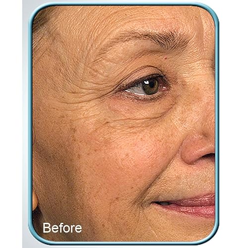 Miniatura 2 de Terapia biológica de arrugas con células madre (juego de 2)