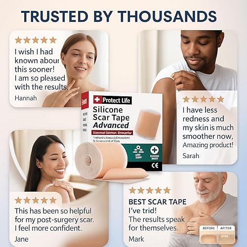 Miniatura 5 de Cinta de silicona de grado médico para cicatrices, formulación adhesiva avanzada (1.6 x 118 pulgadas), tiras de eliminación de cicatrices para