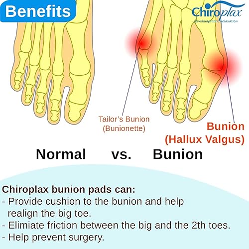 Miniatura 5 de Chiroplax Corrector de juanetes para mujeres y hombres, almohadillas de alivio para hallux valgus, separador de dedos, alisador, protector de férula