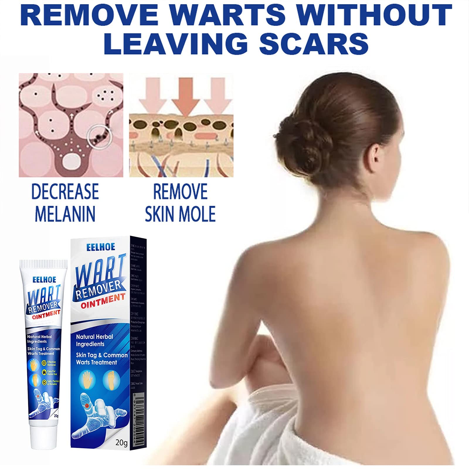 Wart Remover, Wart Cream, Wart Cream is Safe and Effective Suitable for