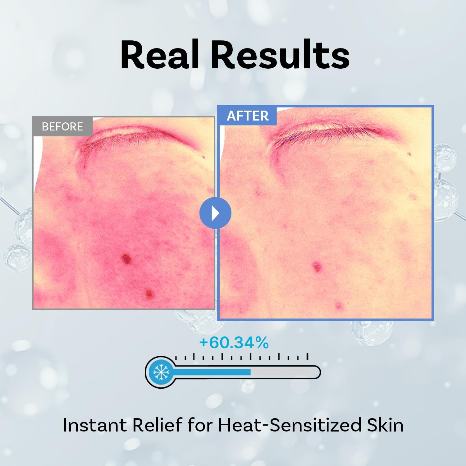 APOTHE Exosome Squal-Tox 3% Ampoule 1.01 fl oz (30ml) – Intense Hydration, Skin Renewal, Brightening & Anti-Wrinkle Care with Exosome Technology and Niacinamide - Image 2