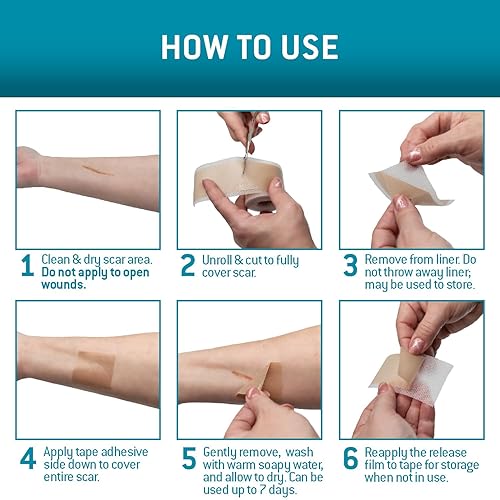 Miniatura 7 de Care Science Cinta de silicona para cicatrices de 1.6 x 120 pulgadas, 1 unidad, cinta para cicatrices quirúrgicas, queloides, eliminación de
