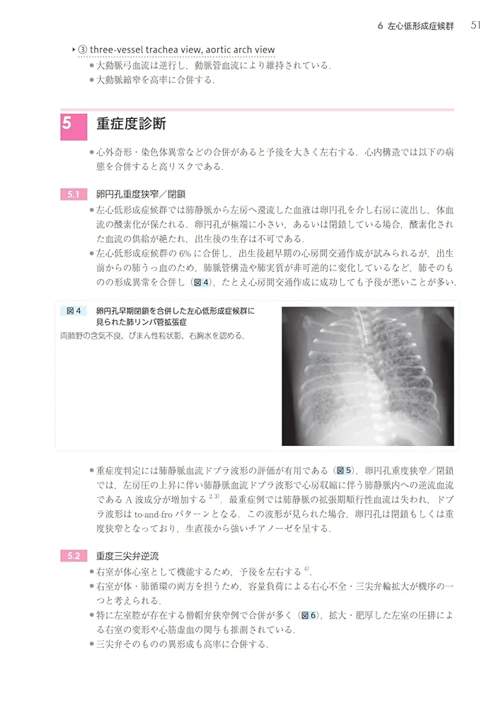 【裁断済】ガイドラインに基づく胎児心エコー テキスト 精査・臨床編 ガイドラインに基づく 胎児心エコーテキスト 精査・臨床編