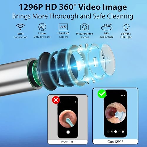 Miniatura 2 de FINSOFT Cámara con herramienta de eliminación de cera de oído, limpiador de oídos con cámara, kit de limpieza de eliminación de cera de oídos con