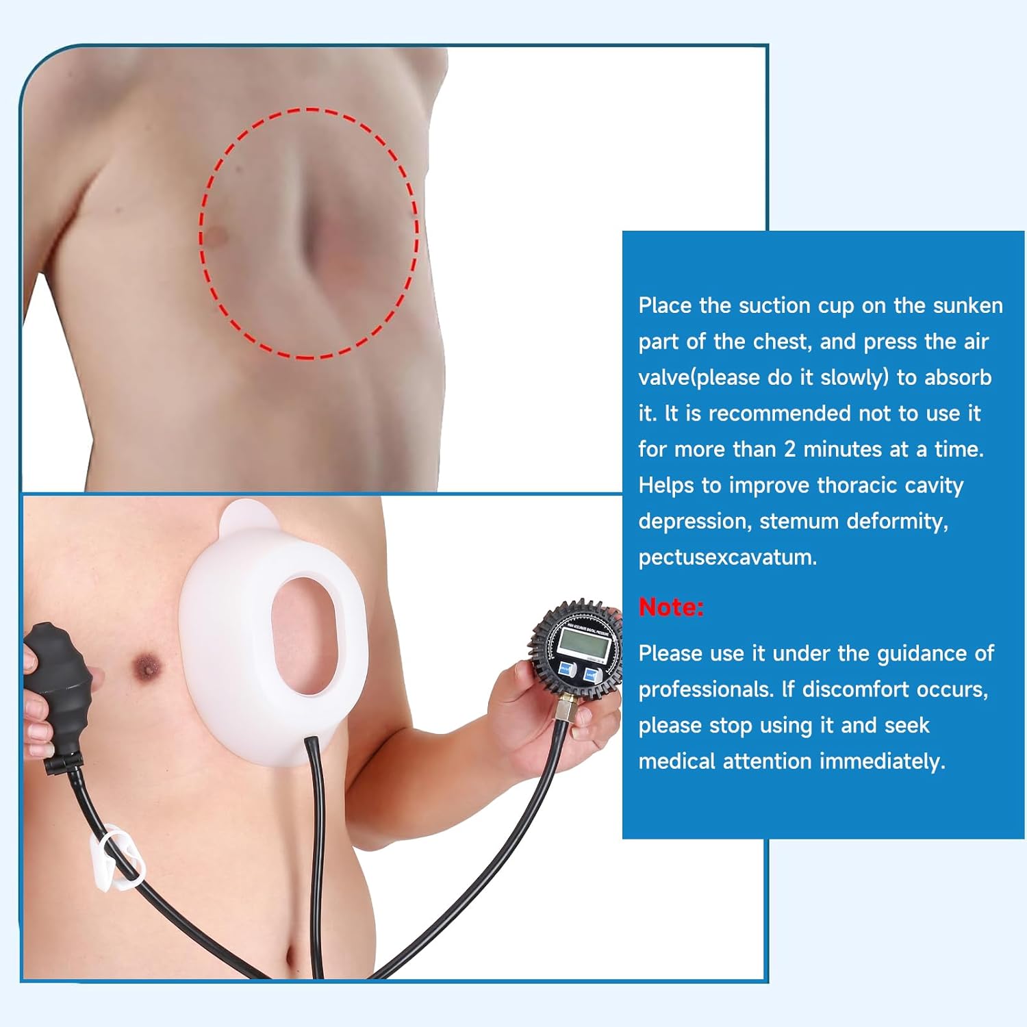 Pectus Excavatum Brace Pectus Excavatum Vacuum Bell Pectus Excavatum Orthosis Sternum Brace Chest Brace for Kids Men Women (Small)