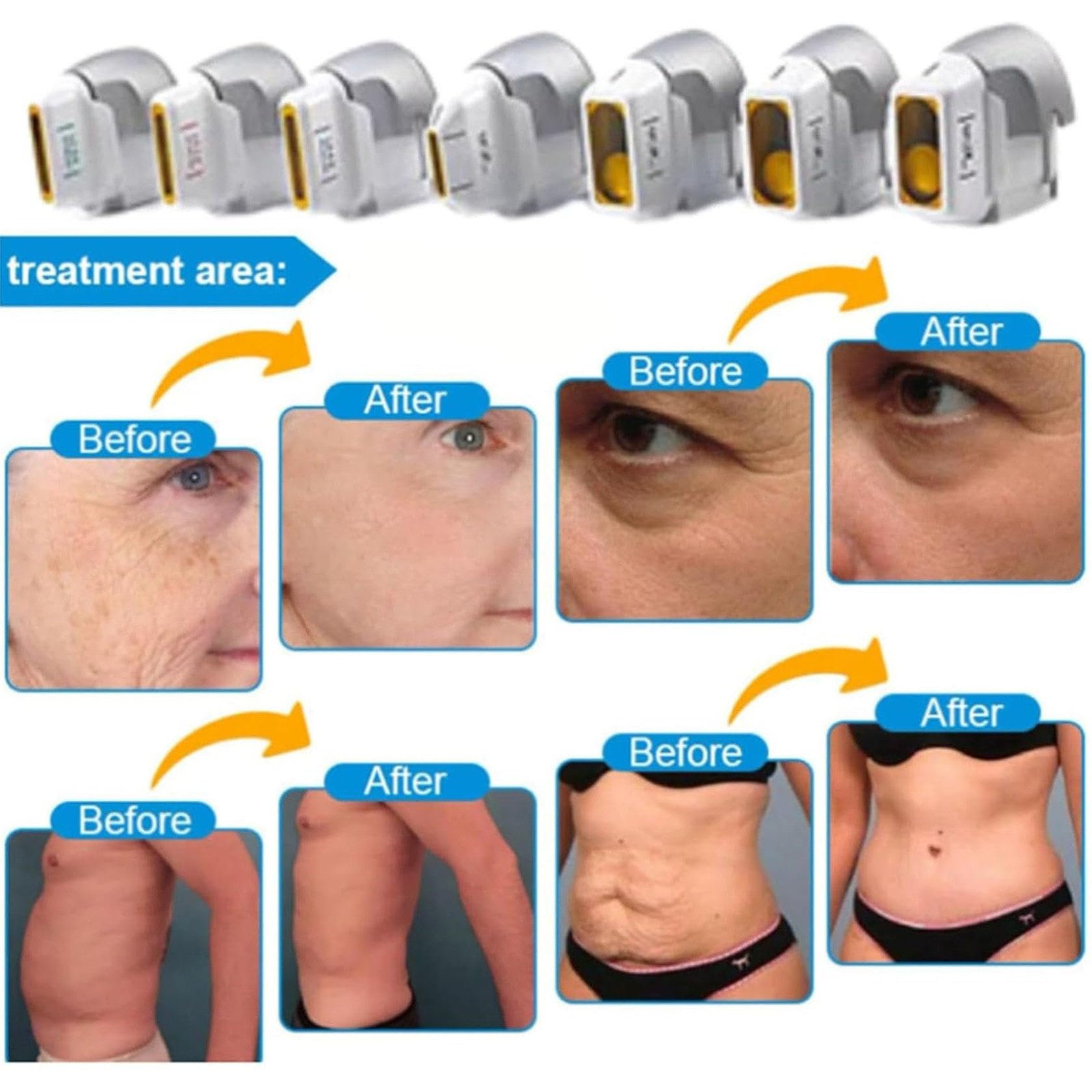7d Hifu Wielofunkcyjne Urządzenie do Pielęgnacji Skóry, Przeciwzmarszczkowe Urządzenie Hifu Beauty do Liftingu Twarzy, Napinania Skóry, Odmładzania Skóry (1.5, 2.0, 3.0, 4.5, 6.0, 9.0, 13mm)