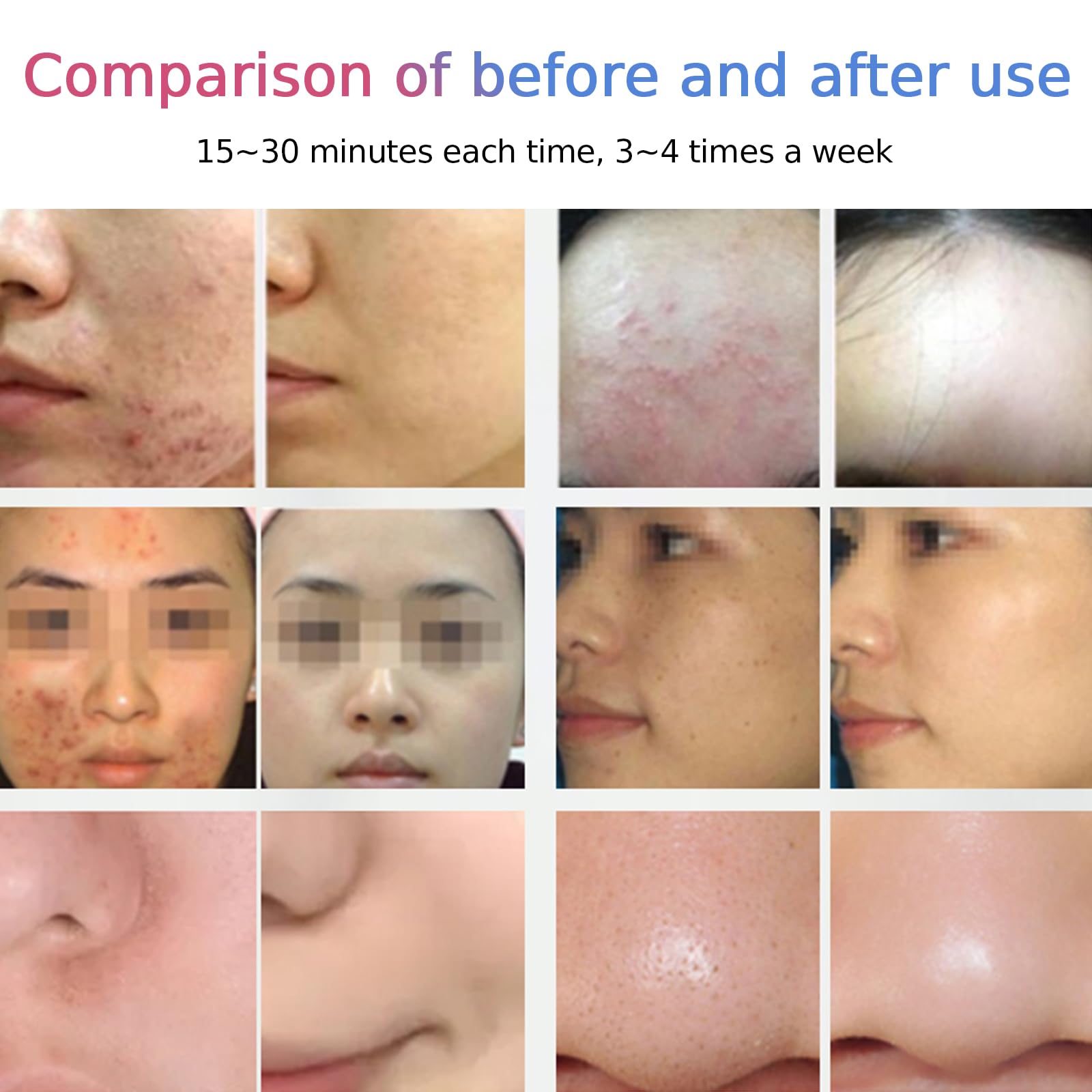 Máscara LED de belleza de 7 colores, máscara facial LED, lámpara de terapia de luz roja plegable para cara y cuerpo, máquina de terapia de luz LED con función de niebla, uso doméstico y de salón