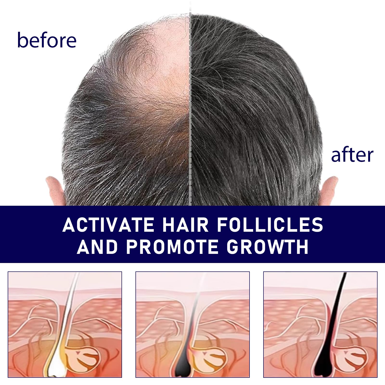 2 * 50ml Serum de Crecimiento del Cabello, Suero Para el Pelo, Loción Anticaida del Cabello Mujer y Hombre, Para Crecimiento y Anticaida Hair Growth, Fortalece el Hair