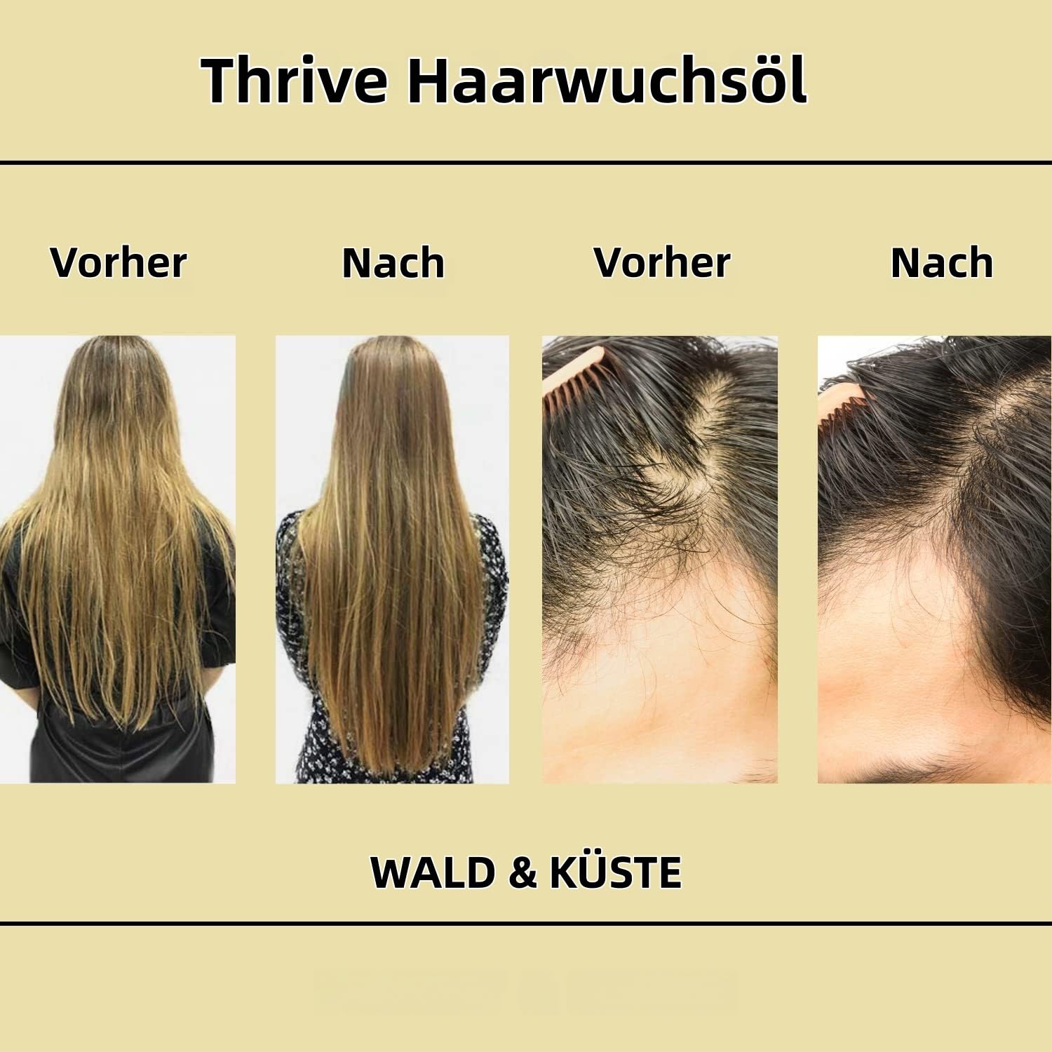 Teluni BabboSow Haaröl-Rosmarin-Haarpflege-Ätherisches Öl (3 Stück)