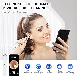 High-Definition Ear Wax Removal, Wireless Ear Cleaner, Safe and Gentle Ear Wax Removal Kit, Rechargeable Ear Cleaner with Camera and Light, Ear Cleaning Kit for Android and iOS (White)
