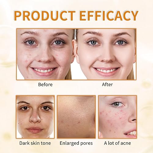 Miniatura 7 de Tónico exfoliante de ácido glicólico al 7%, tónico facial exfoliante, tóner minimizador de poros, piel suave, tono uniforme, fórmula hidratante