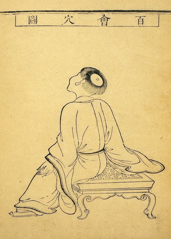 Vintage Anatomy Acupuncture 'Acumoxa Location of The Baihui Point', China, 1680, Reproduction 200gsm A3 Vintage Medical Acupucture Poster