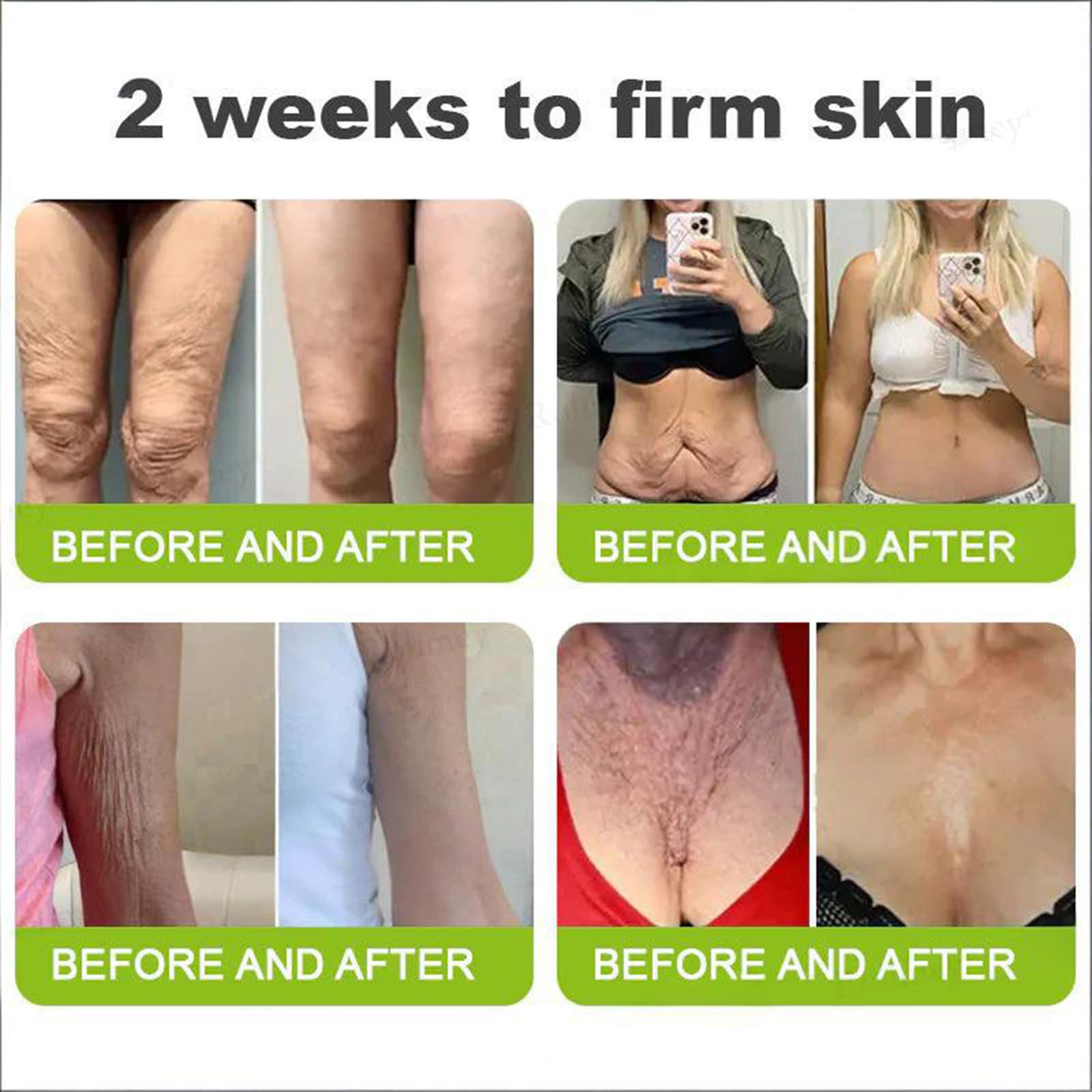 Rolimey Retinal Wrinkle-Lift Tightening Cream for Face and Body