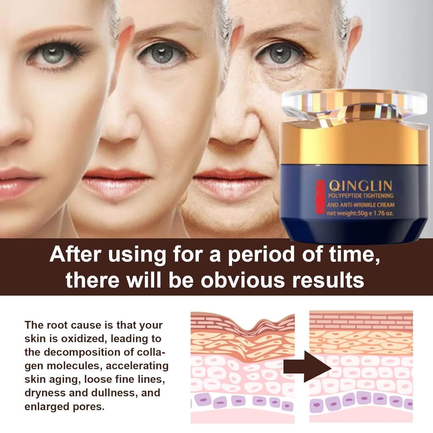 Amazon.com: UUniqueGift Qinglin Face Cream, Crema Para Arrugas