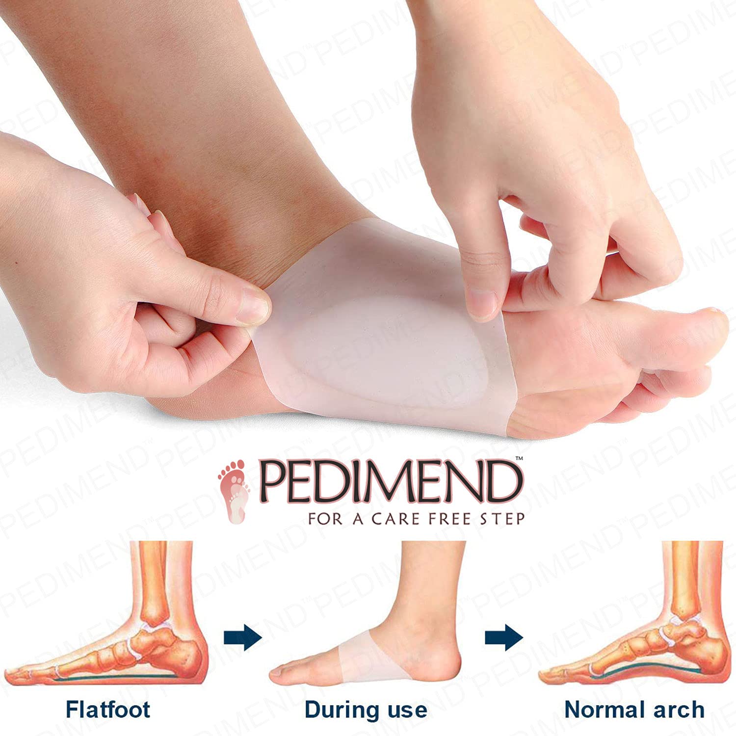 PedimendTM - Inserti per scarpe in gel di silicone per piede piatto e fascite plantare, sollievo dal dolore