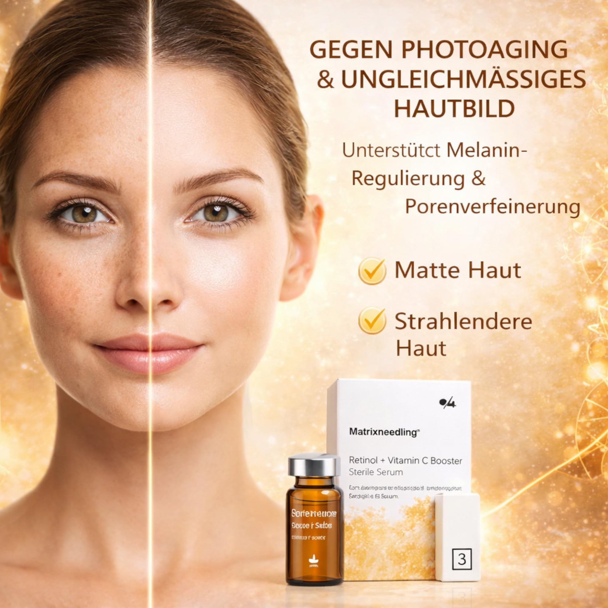 Matrixneedling™ Retinol Vitamin C Serum 10 ml – Hochdosiertes Retinol Serum & Vitamin C Booster – Steriles Microneedling Serum für Dermapen & Dermaroller – Anti Falten Serum, Collagen Booster