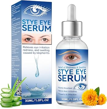 Stye Eye Treatment, Natural Eye Serum, Eye Drops for Infected Eyes, Styes, Blepharitis, Chalazions and Dry Eyes Treatment, Daily Area Cleansing, Relieves Dryness and Restores Healthier Skin