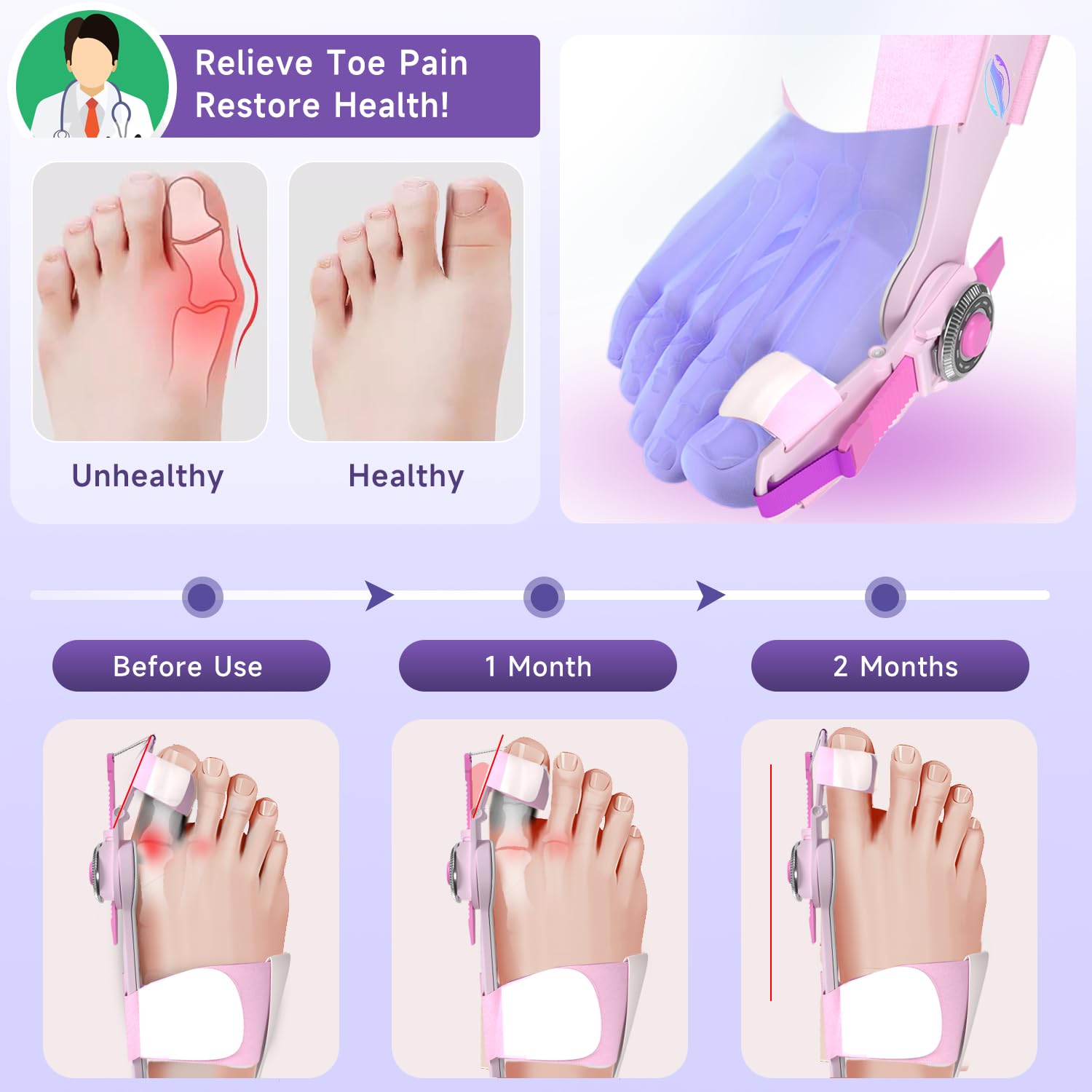 HUQKIYA Bunion Corrector for Women & Men, Orthopedic Bunion Splint with Toe Separator Adjustable Toe Straightener Suitable for Left/Right Feet Hallux Valgus Relief (Pink 1Pcs)